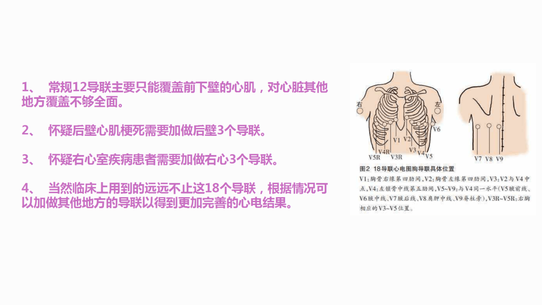 【ppt】心电图机操作规程