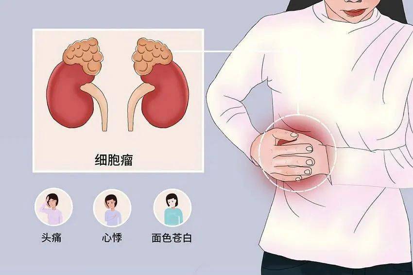 有没有肾上腺的问题,比如像库欣综合症,acth皮质醇分泌有异常的时候