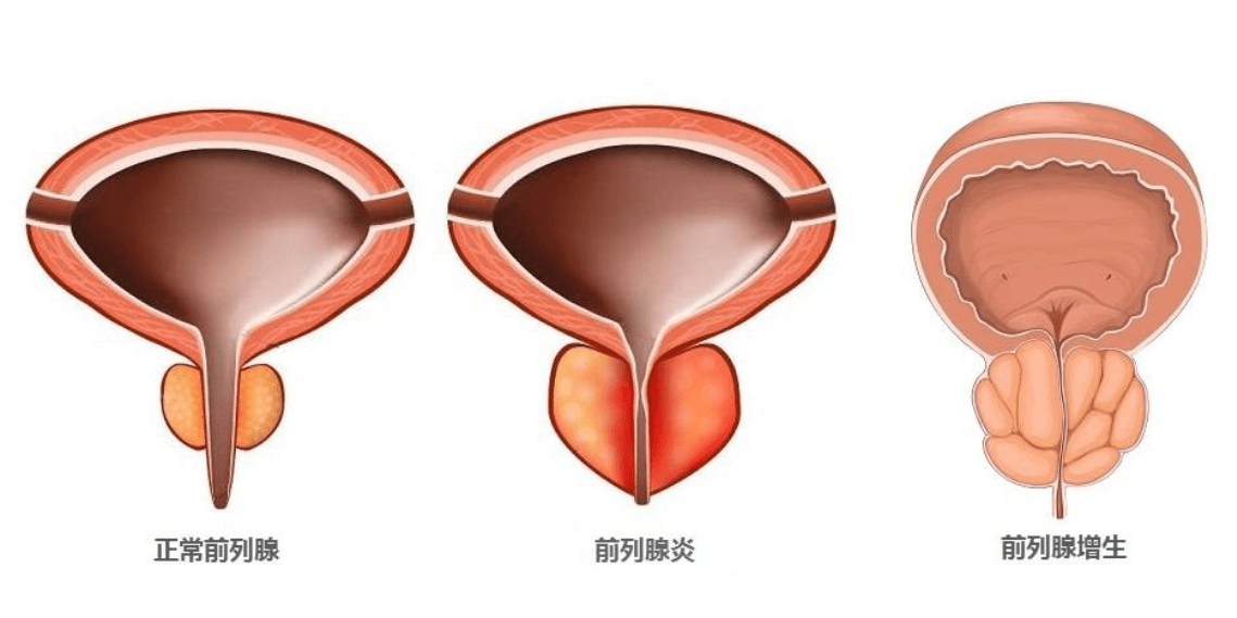 双氢睾酮软膏香港代购图片