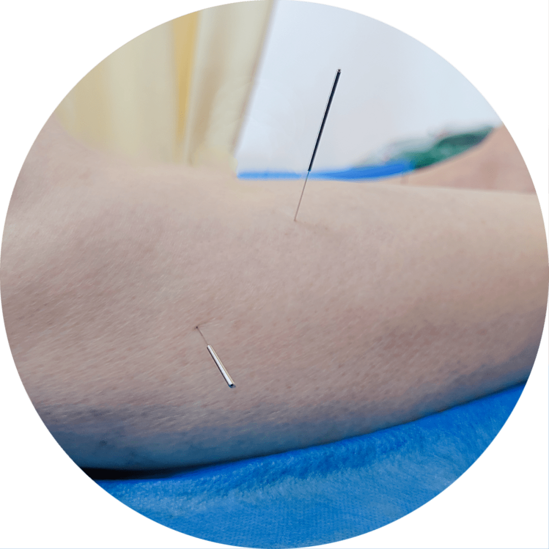 五行针灸,解锁你身心的密码_治疗_疾病_医生