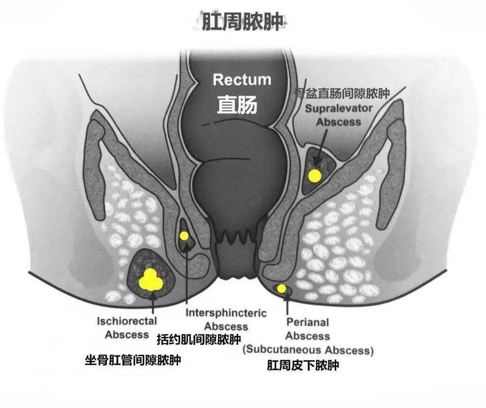 健康肛门 正常图片