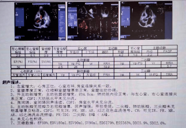 近期,广东医科大学附属医院陈建英教授带领团队成功通过tavr完成了