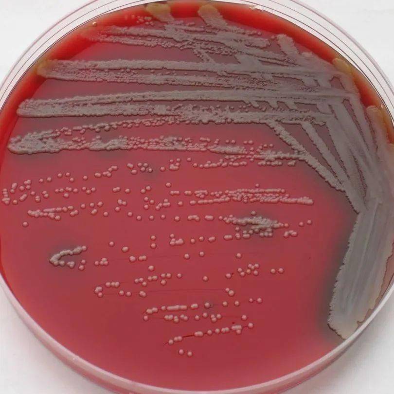 大多数细菌和霉菌已经停止生长,但是奥斯陆莫拉菌仍然能够活跃地蹦踧