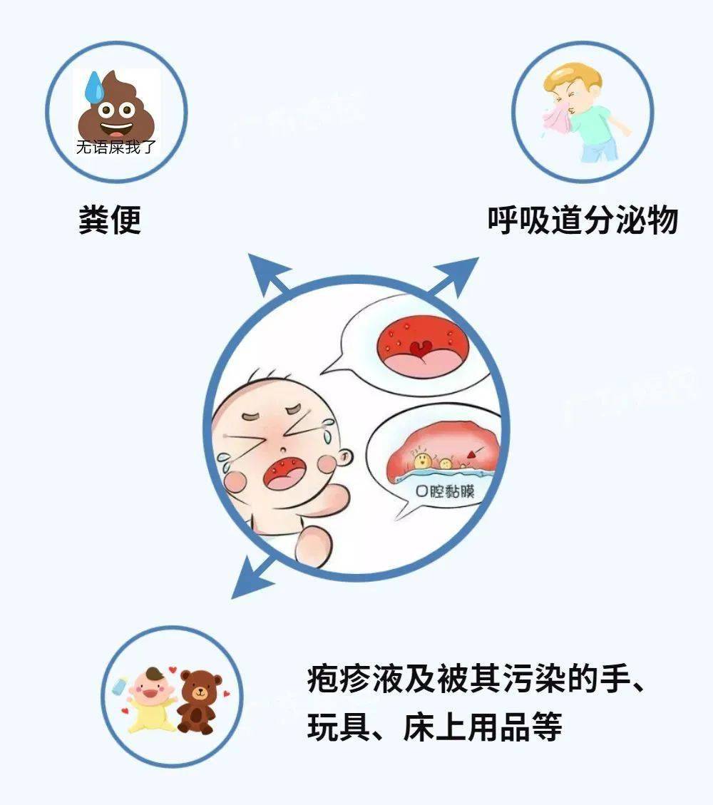 【科普】近期疱疹性咽峡炎高发,防护要点看这里!_患儿_症状_儿童