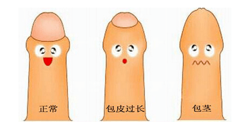 包皮过长如果发生包皮红肿包皮口流脓,考虑发生细菌感染所致包皮阴茎