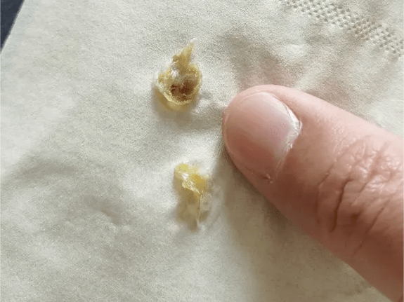 如何优雅而又健康的清理鼻屎?_鼻腔_黏膜_免疫力