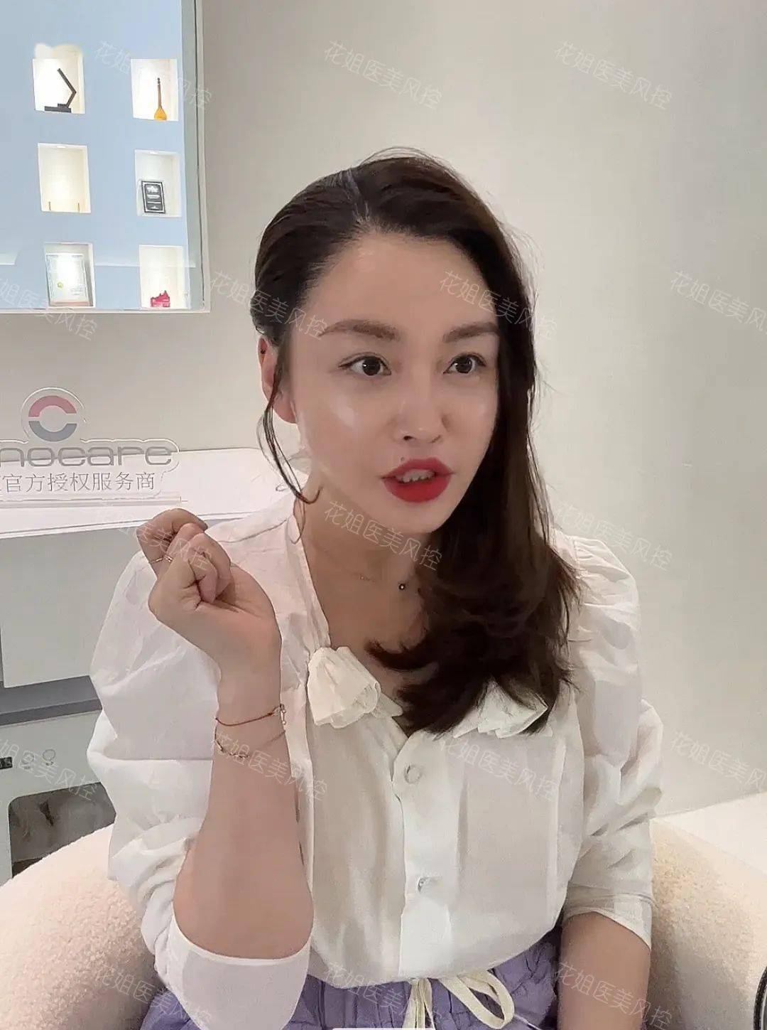 花姐植眉分享篇_技术_医生_效果