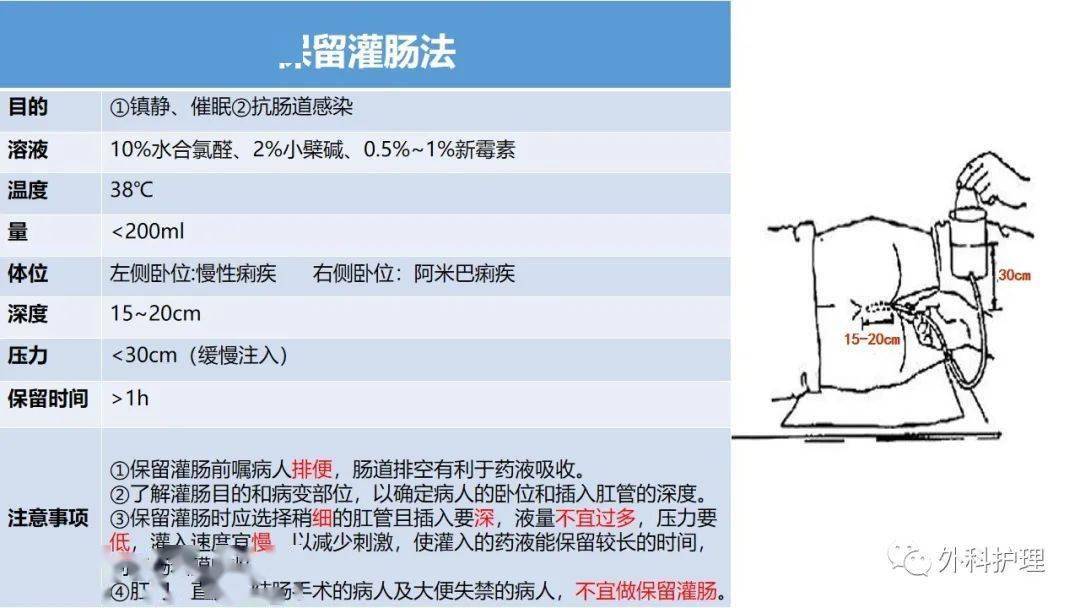 肛管排气术图片