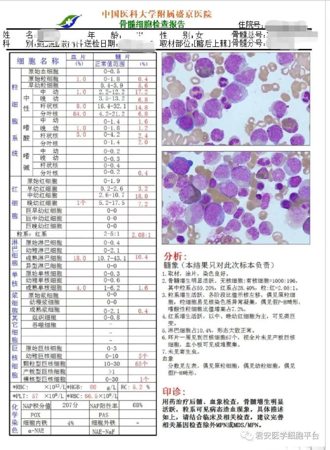 外周血涂片报告图片