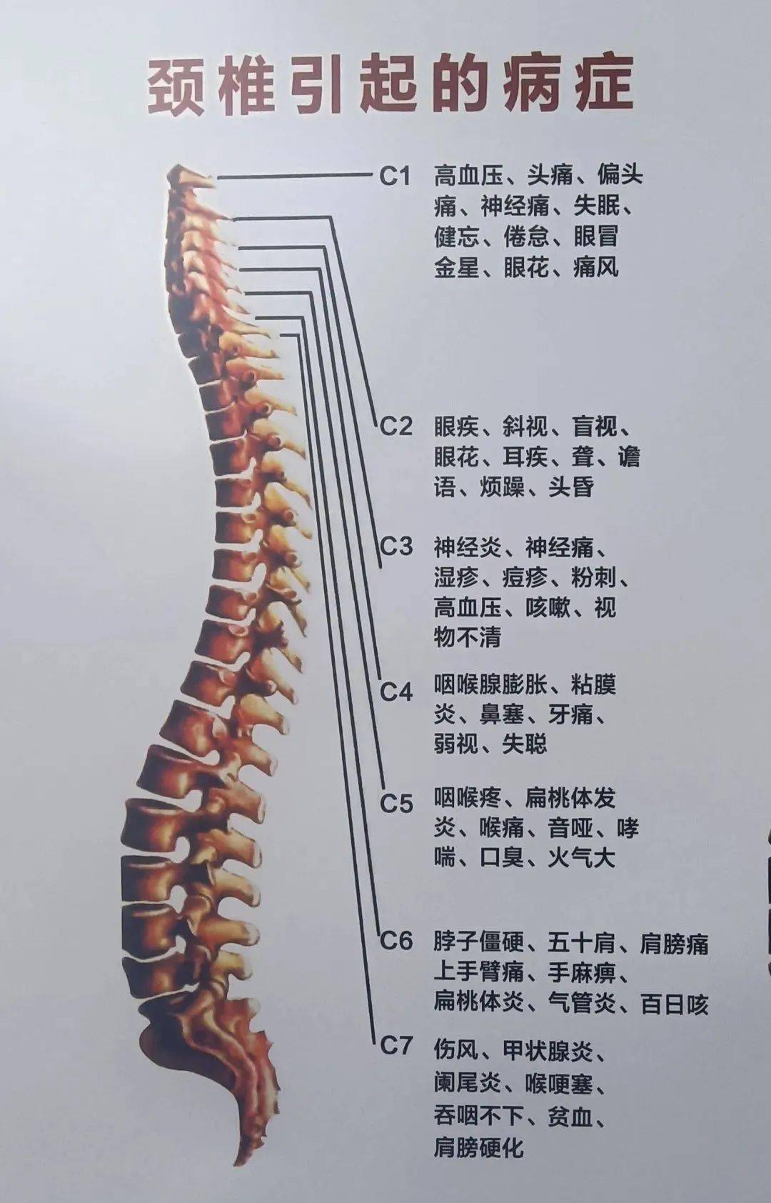 人体脊椎疾病对照表图片