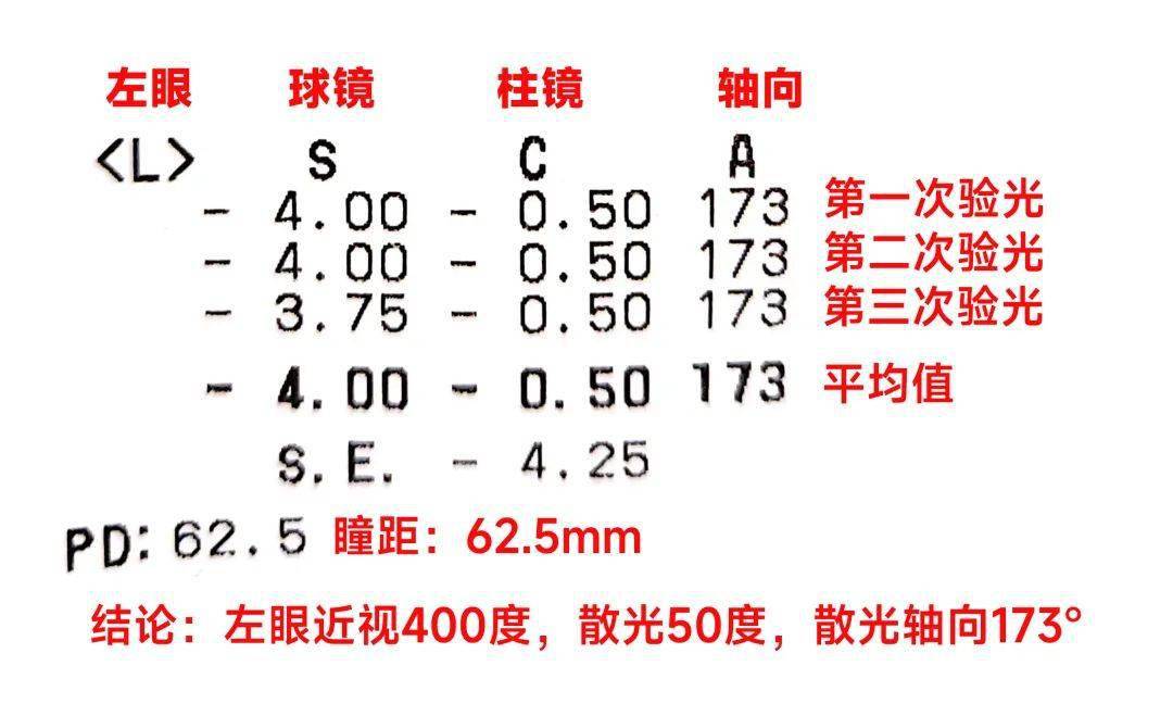 瞳距字母图片