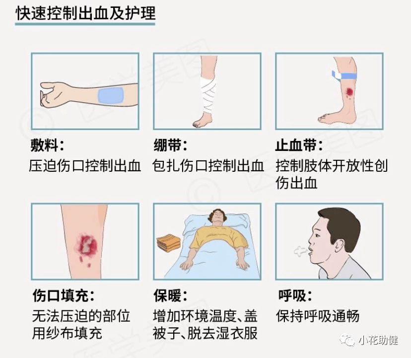 创伤失血性休克的应对及护理措施_监测_治疗_组织