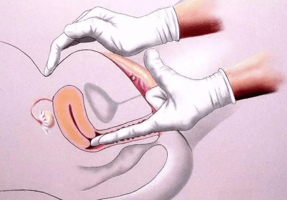 为什么阴道会排气 为什么阴道会排气