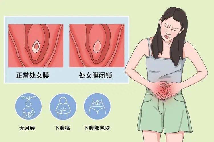 1,青春期后无月经初潮,2,出现周期性的下腹部疼痛,但没有出现月经血3