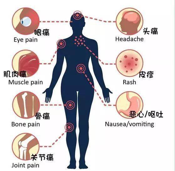 三痛:剧烈头痛,全身关节痛,肌肉酸痛;三红:面红,颈红,胸红;皮疹:四肢