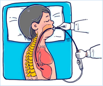 超声科|三维经食道超声心动图,精准排查心脏疾病手术隐患_检查_患者