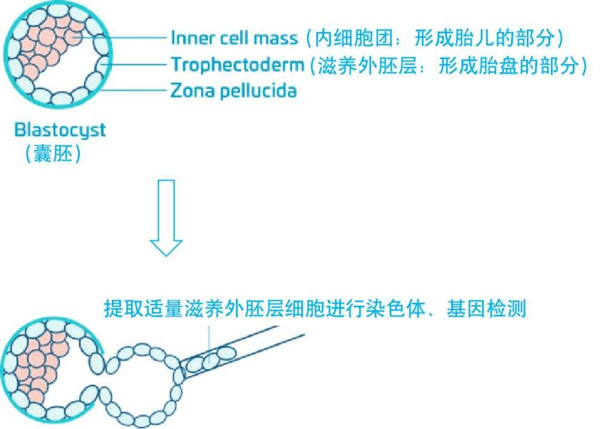 科学前沿|再登学科顶刊!生殖中心研究:第三代试管治疗的囊胚活检不增加母儿风险_医学_广东省_辅助