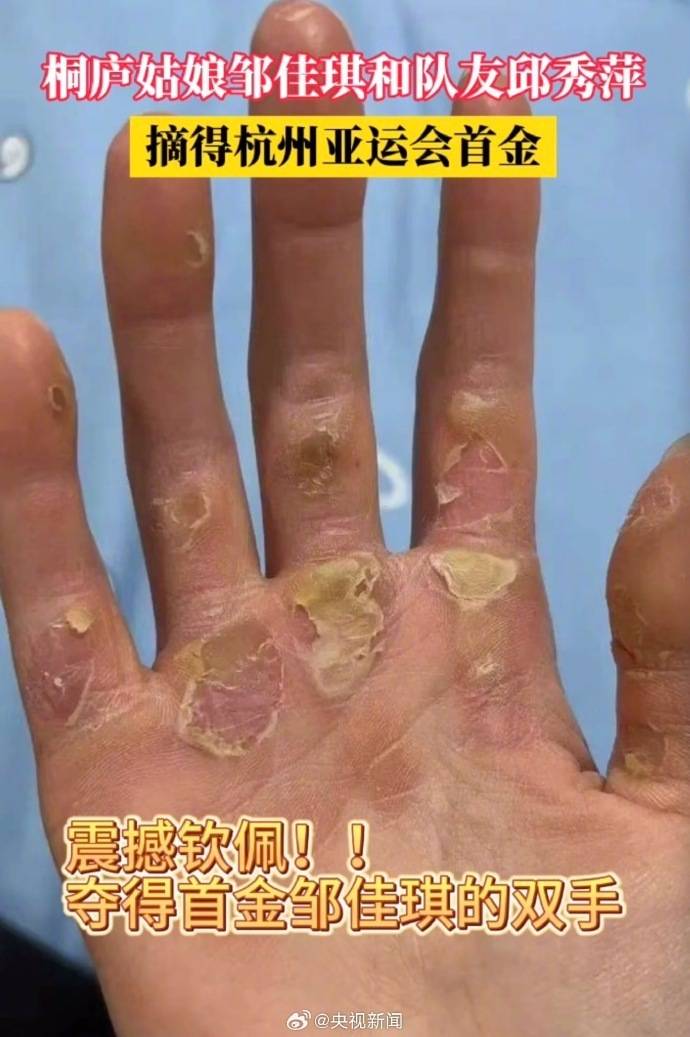 夺得首金的姑娘双手满是老茧_中国_网友_新闻