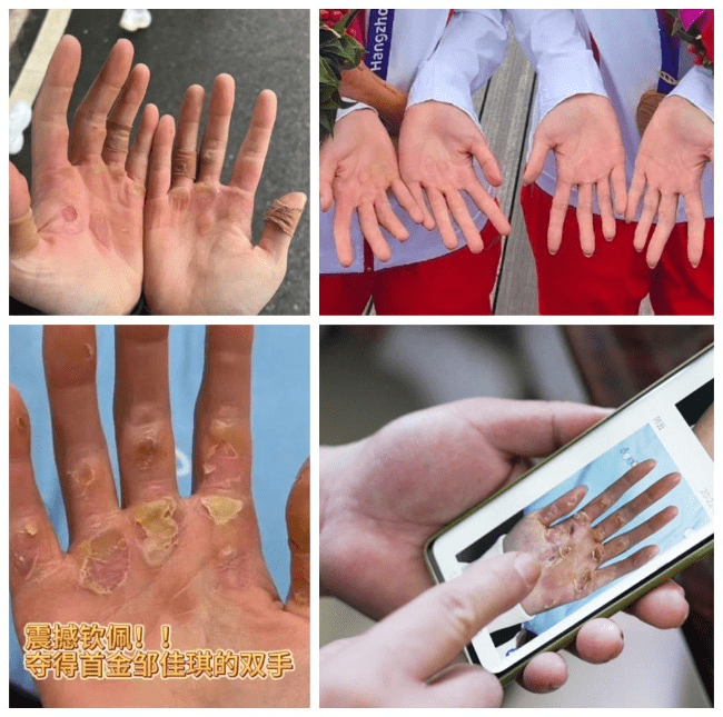 新华网评:手上的老茧,是奋斗者的勋章_亚运会_首金_金牌