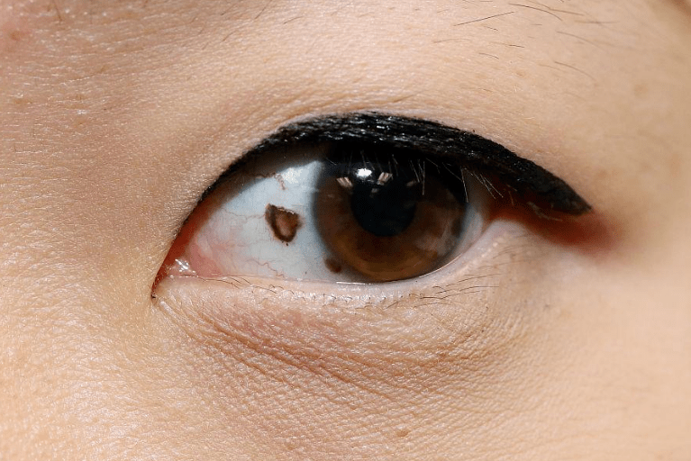 医生:若有这4种异象,建议尽早筛查_疾病_保护_身体