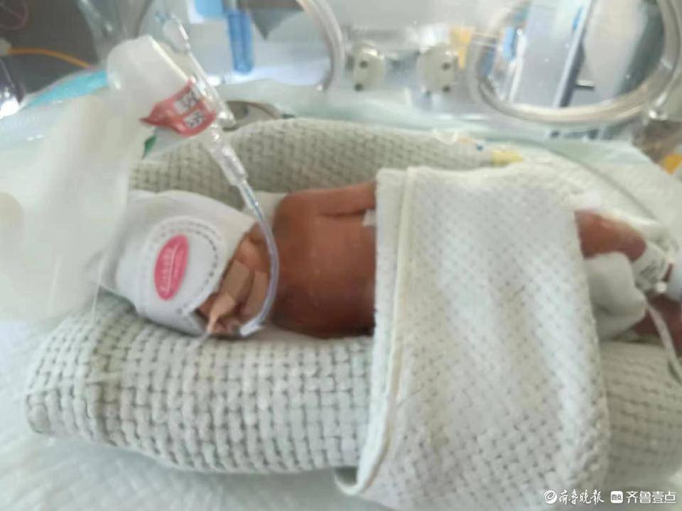 体重900克,出生时仅手掌大,泰安26周超早产儿顺利出院