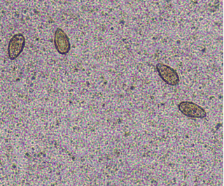 寄生虫虫卵镜下图片图片