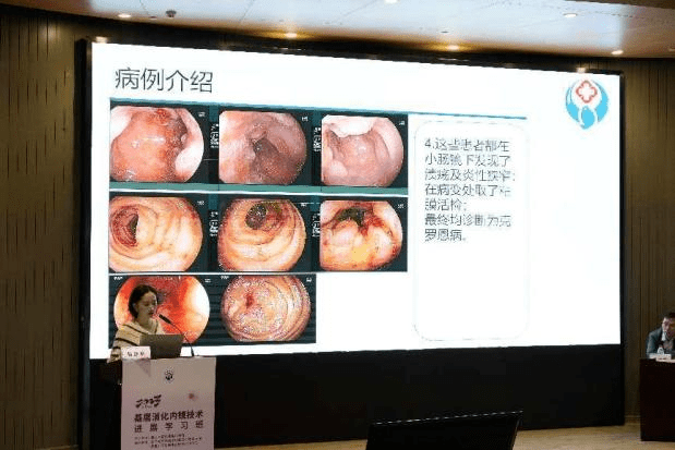 医教动态 | 我院成功举办上海市继教班——基层医院消化内镜技术新