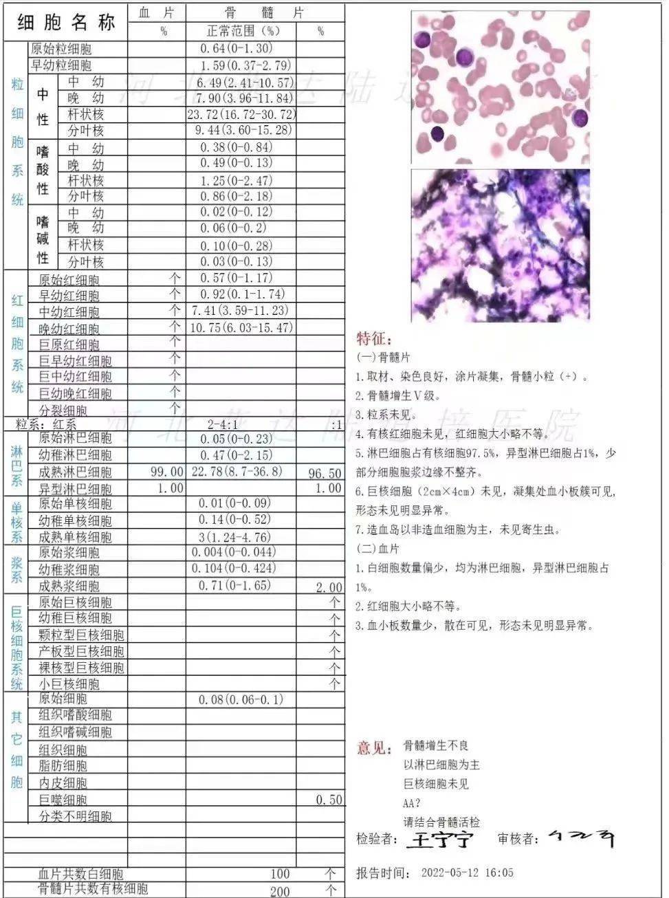 骨穿形態報告常見問題?三天內嚴禁洗澡.