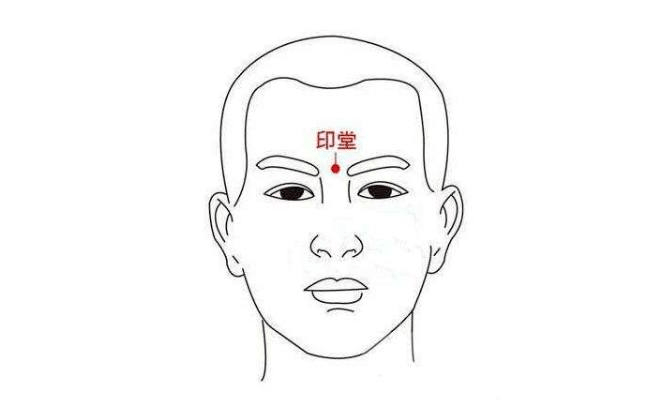 百会除了中草药方,该睡眠门诊还有一套神五针,利用针灸刺激五个穴位