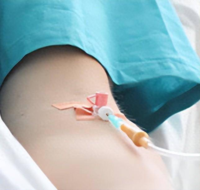 产科医生宠爱的"麦角新碱",可以静脉滴注吗?_药物_注射液_生产