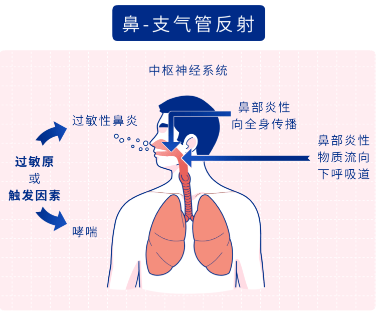 過敏性鼻炎和哮喘也有相似的發病機制,當患兒在過敏性鼻炎發作時,鼻腔