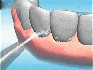 在你的牙齿还没掉光之前，请扔掉你的“止血牙膏”