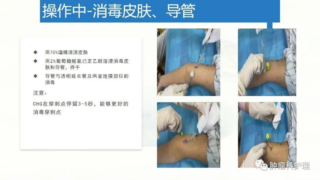 【ppt】經外周靜脈置入中心靜脈導管(picc)的規範化維護_護理_臨床