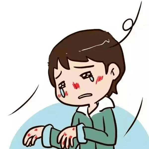 冻疮年年复发,又疼又痒?防治指南速速收藏!_皮肤_局部_组织