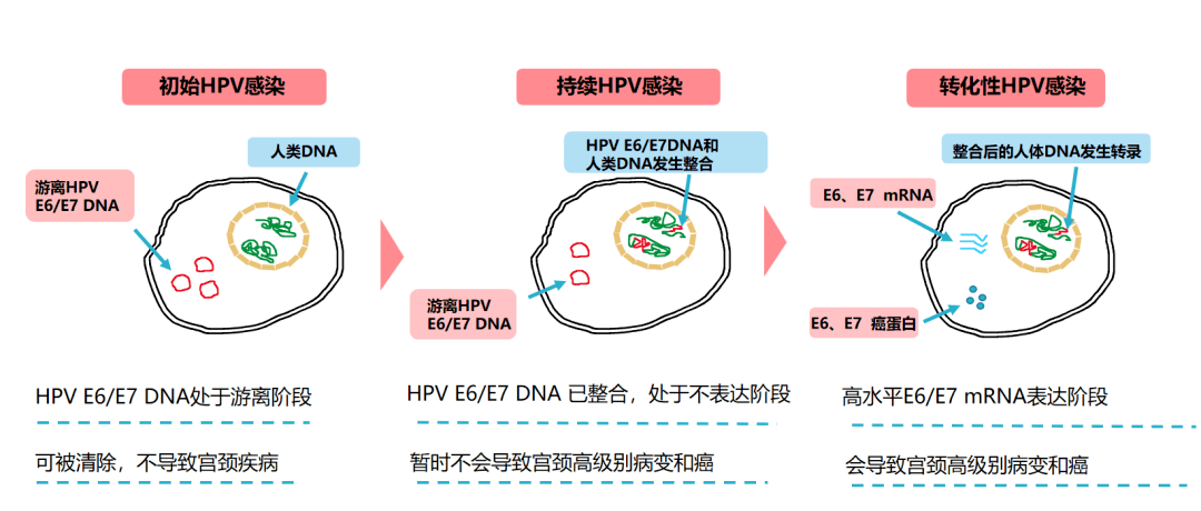 1,发现高风险宫颈病变患者:对于已感染hpv且癌基因表达的患者,该检查