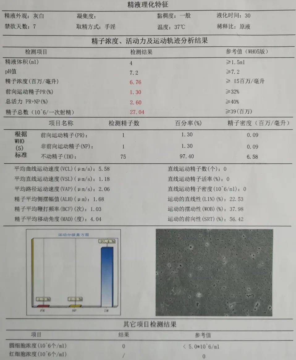 做了精液检查后得知精子数量极其少顿时慌了神