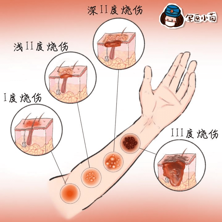 伤口感染卡通图片图片