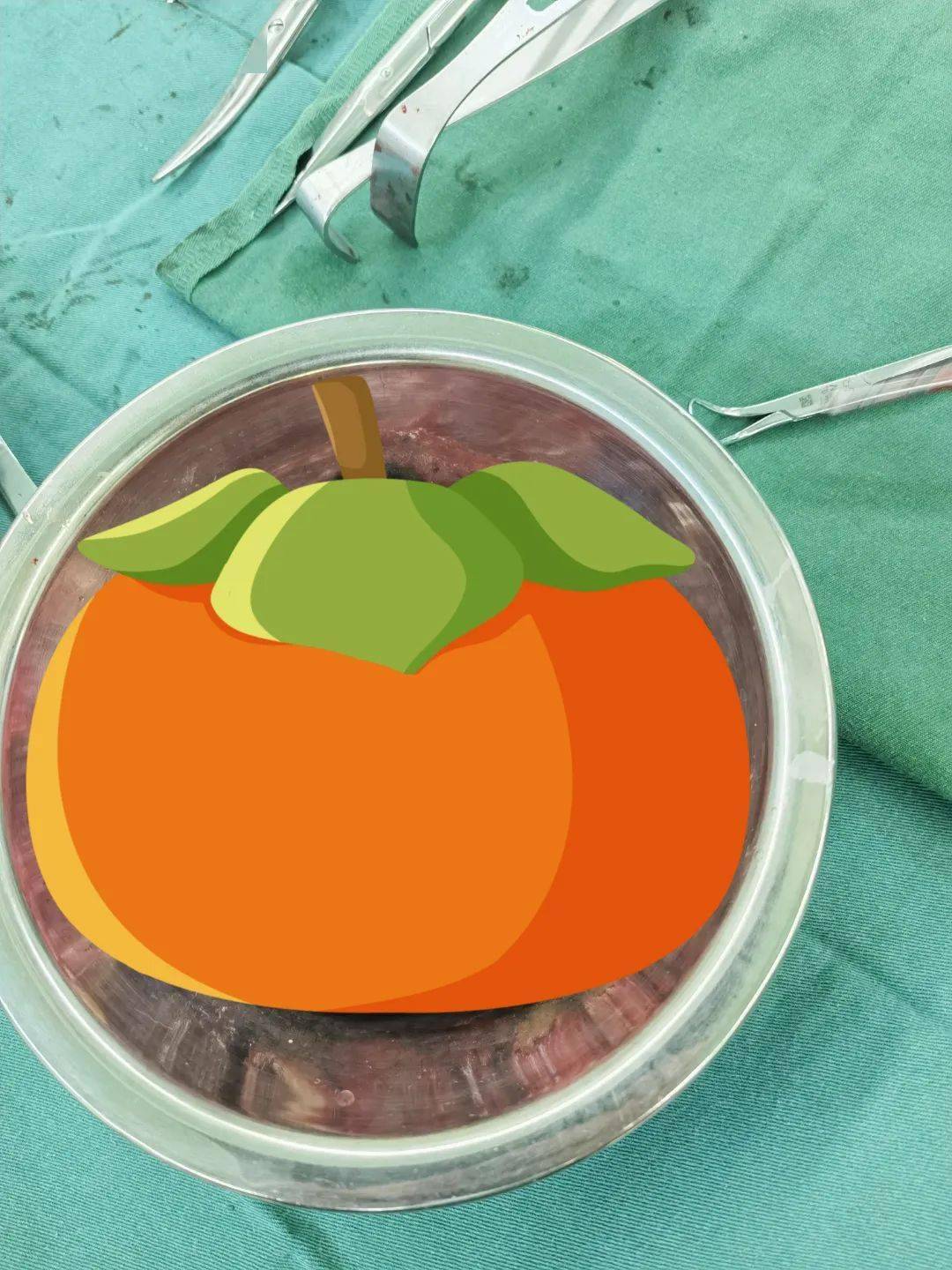 【医疗技术】臀部长了30多年的"烦恼",这次终于"减负"了_肿块_患者