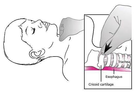 脖子环状软骨图片图片