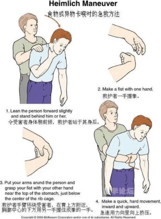 预防误吸发生的措施1.尽量选择自主进食,避免不停催促和喂食.