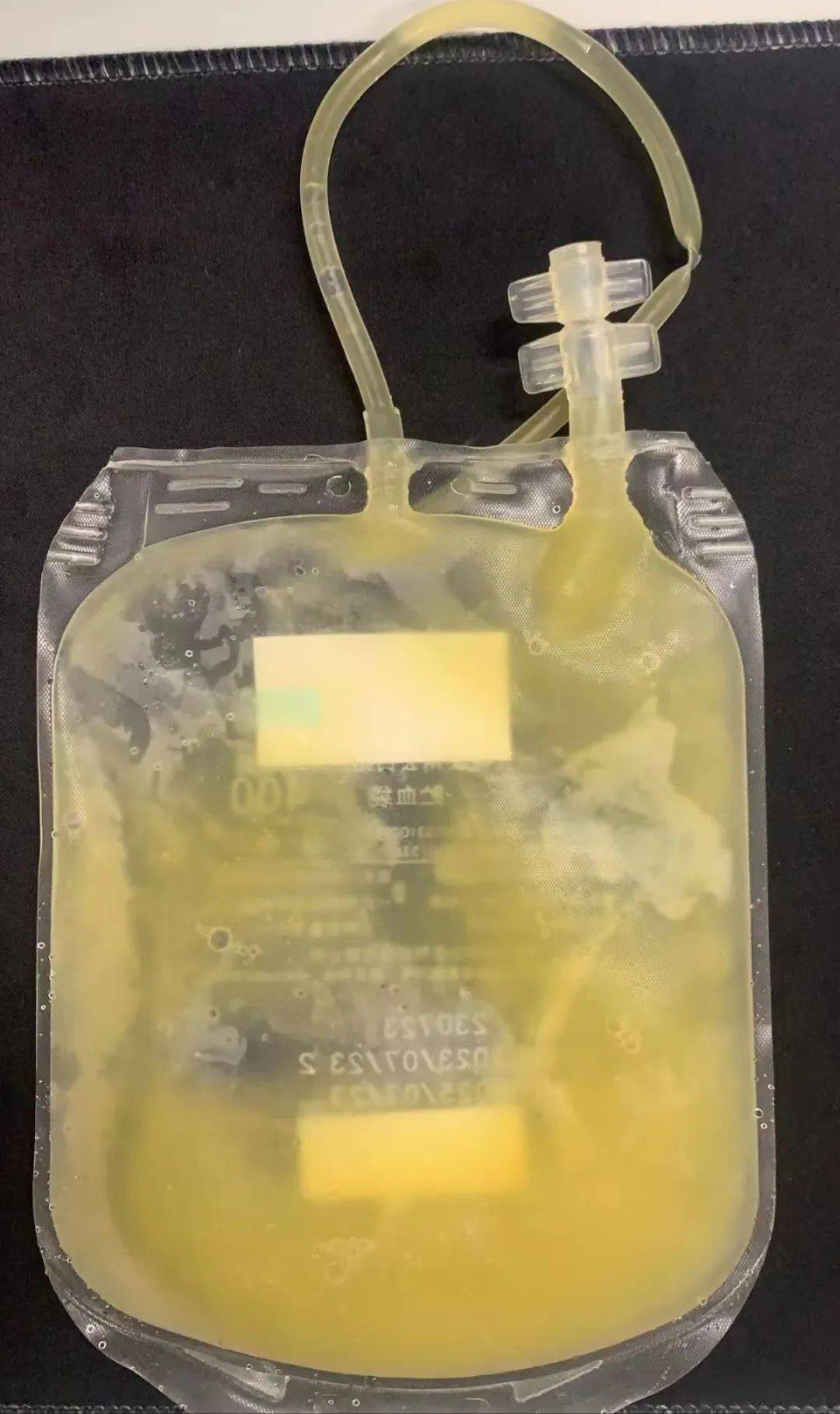 这就要从血浆说起了,当你把新鲜冰冻血浆从低温冰箱里拿出来,放到适当